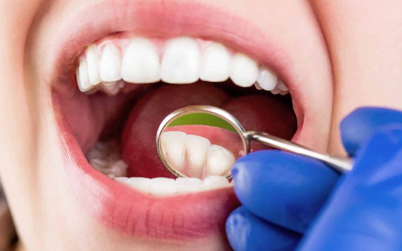 Dental Tourism in Sri Lanka: Treatment + a Holiday