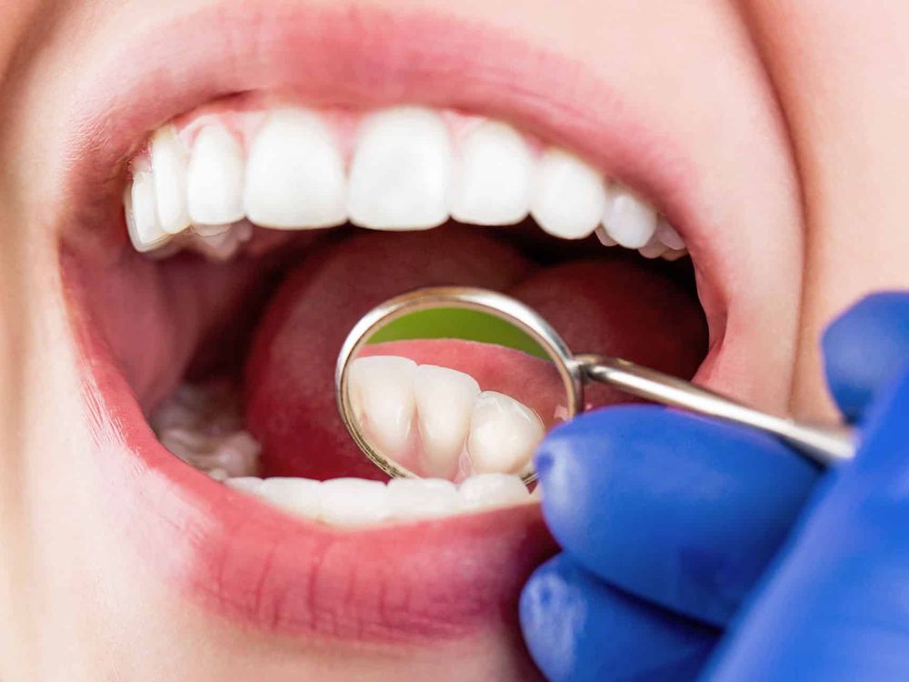Dental care in Sri Lanka — Beyond Waves Leisure